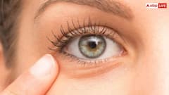 डार्क सर्कल्स कम करने के लिए एलम का इस्तेमाल, क्या यह प्राकृतिक उपाय सच में काम करता है?