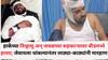 Beed Crime News : लक्ष्मण हाकेंच्या विश्वासू अन् जवळच्या सहकाऱ्यावर बीडमध्ये हल्ला; जेवायला थांबल्यानंतर 40 जणांनी लाठ्या-काठ्यांनी केली मारहाण, बीडमधील घटना