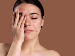 Skin Care Tips: घर बैठे पाएं ग्लोइंग स्किन, आजमाएं अजवाइन पानी का नुस्खा