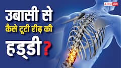 सुबह उठते ही उबासी ली और टूट गई रीढ़ की हड्डी, डॉक्टर से जानें क्यों हुआ ऐसा?