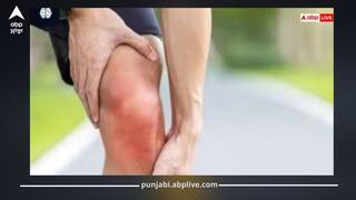 ਕੈਲਸ਼ੀਅਮ ਨਾ ਲੈਣ ਨਾਲ ਸਰੀਰ 'ਚ ਹੋਣਗੇ 5 ਬਦਲਾਅ, ਕਮਜ਼ੋਰ ਹੱਡੀਆਂ ਤੋਂ ਲੈ ਕੇ ਇਨ੍ਹਾਂ ਸਮੱਸਿਆਵਾਂ ਨਾਲ ਕਰਨਾ ਪਵੇਗਾ ਸਾਹਮਣਾ