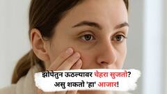 झोपेतुन ऊठल्यावर चेहरा सुजतो? असु शकतो 'हा' आजार! वाचा पुर्ण माहिती...