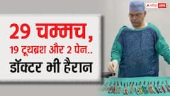 बाप रे बाप! युवक के पेट से निकले 29 चम्मच और 19 टूथब्रश, डॉक्टर भी रह गए हैरान