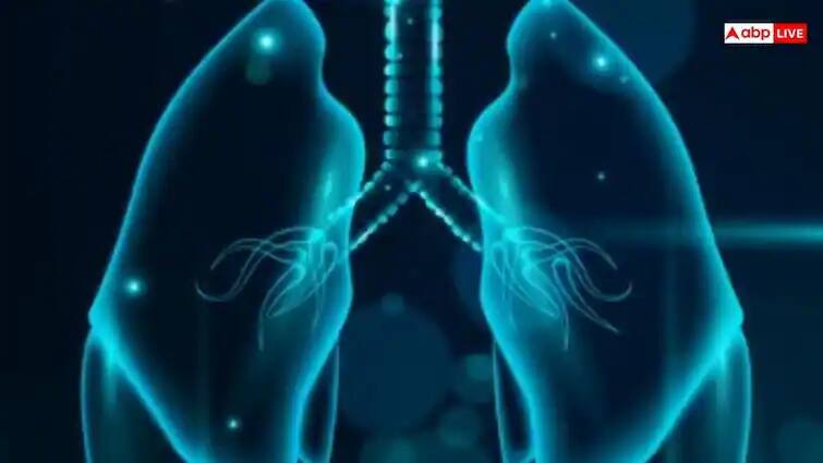 health tips world lung day 2025 symptoms of lungs filled with water  World lung day: જો શરીરમાં દેખાવા લાગે આ લક્ષણો તો સમજી લો ફેફસામાં ભરાઈ ગયું છે પાણી, તુરંત કરો ડોક્ટરનો સંપર્ક