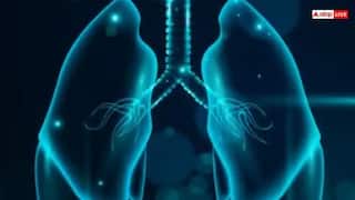 World lung day: જો શરીરમાં દેખાવા લાગે આ લક્ષણો તો સમજી લો ફેફસામાં ભરાઈ ગયું છે પાણી, તુરંત કરો ડોક્ટરનો સંપર્ક