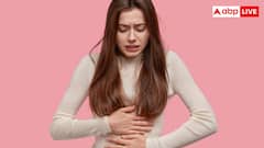 PCOS का असर सिर्फ ओवरी तक सीमित नहीं, त्वचा और बालों पर भी दिखते हैं लक्षण