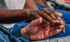 ਬ੍ਰੇਨ ਡੈੱਡ ਵਿਅਕਤੀ ਤੋਂ ਕਿੰਨੇ ਲੋਕਾਂ ਨੂੰ ਮਿਲ ਜਾਂਦੀ ਜ਼ਿੰਦਗੀ? ਅੰਗਦਾਨ ਲਈ ਕਿਹੜਾ ਸਮਾਂ ਸਭ ਤੋਂ ਵਧੀਆ