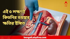 kidney Disease : চোখে এই ৫ সমস্যাই বলে দেবে, আপনার কিডনি কতটা খারাপ অবস্থায়