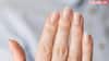 White Marks On Nails: आपके नाखूनों पर बन गया है व्हाइट निशान, जानें किस बीमारी का है संकेत