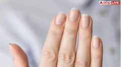 White Marks On Nails:  ਜੇ ਤੁਹਾਡੇ ਨੌਹਾਂ 'ਤੇ ਵੀ ਬਣ ਗਏ ਨੇ ਚਿੱਟੇ ਨਿਸ਼ਾਨ ਤਾਂ ਜਾਣੋ ਇਹ ਕਿਹੜੀ ਬਿਮਾਰੀ ਵੱਲ ਕਰ ਰਹੇ ਨੇ ਇਸ਼ਾਰਾ ?