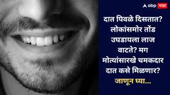 Teeth Cleaning: दात पिवळे दिसतात? लोकांसमोर तोंड उघडायला लाज वाटते? मग मोत्यांसारखे चमकदार दात कसे मिळणार? जाणून घ्या...