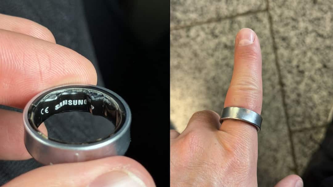 samsung galaxy ring swelling incident battery problem safety concern burst news Samsung Galaxy Ring Swelling Lands Influencer In Hospital: Here's What Happened