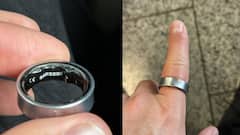 Samsung Galaxy Ring Swelling Lands Influencer In Hospital: Here's What Happened