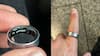 Samsung Galaxy Ring Swelling Lands Influencer In Hospital: Here's What Happened