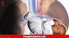 সর্দির ওষুধ থেকে ভয়ানক সংক্রমণ! বিকল হচ্ছে কিডনি, ১৫ দিনে পরপর শিশুমৃ্ত্যু