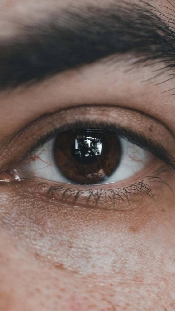 डार्क सर्कल हटाने का ये है सबसे बेस्ट तरीका