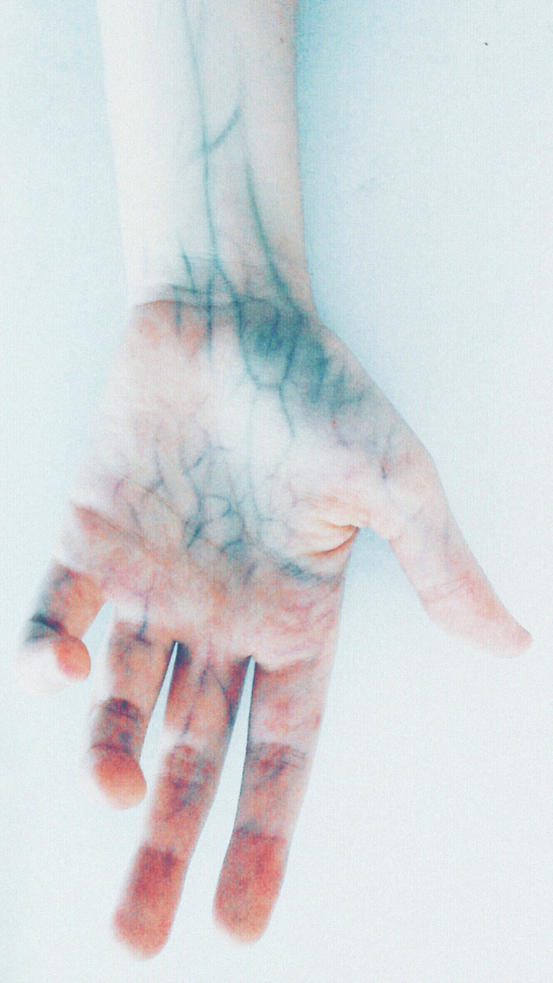 3 Vitamin Deficiencies That Cause Numbness In Hands And Feet