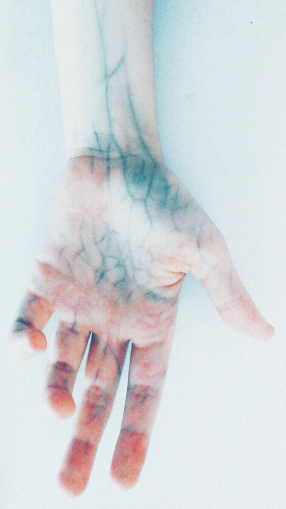 3 Vitamin Deficiencies That Cause Numbness In Hands And Feet