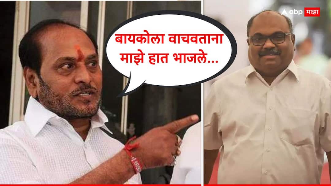 Ramdas Kadam: स्टोव्हचा भडका उडाला अन् माझी बायको जळाली, या हातांनी तिला वाचवलं; रामदास कदमांचं परबांना प्रत्युत्तर Ramdas Kadam press conference slams Anil Parab accusations Ramdas Kadam: स्टोव्हचा भडका उडाला अन् माझी बायको जळाली, या हातांनी तिला वाचवलं; रामदास कदमांचं परबांना प्रत्युत्तर