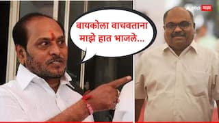 Ramdas Kadam: स्टोव्हचा भडका उडाला अन् माझी बायको जळाली, या हातांनी तिला वाचवलं; रामदास कदमांचं परबांना प्रत्युत्तर