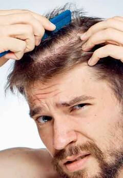 Hair Fall Cure : केसगळतीवर औषधं घेताय? प्रजननक्षमतेवर कसा परिणाम होतो? जाणून घ्या