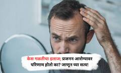 Hair Fall Cure : केसगळतीवर औषधं घेताय? प्रजननक्षमतेवर कसा परिणाम होतो? जाणून घ्या