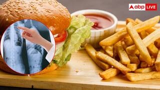 सिगरेट और शराब नहीं, खाने में लेते हैं ये फूड तो भी हो सकता है फेफड़ों का कैंसर