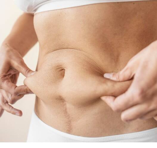 ਪੇਟ ਦੀ ਚਰਬੀ ਨਾਲ ਔਰਤਾਂ 'ਚ ਇਸ ਕੈਂਸਰ ਦਾ ਵੱਧ ਖ਼ਤਰਾ, ਇਵੇਂ ਦੇ ਲੱਛਣ ਆਉਂਦੇ ਨਜ਼ਰ