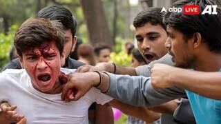 Hardoi News: चोरी के आरोप में युवक को बनाया बंधक, दबंगों ने बेरहमी से पीटा