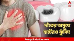 দাঁতের হাল খারাপ, রক্ত পড়ে! পাত্তা দিচ্ছেন না? ডেকে আনতে পারে হার্ট অ্যটাক-স্ট্রোকও!