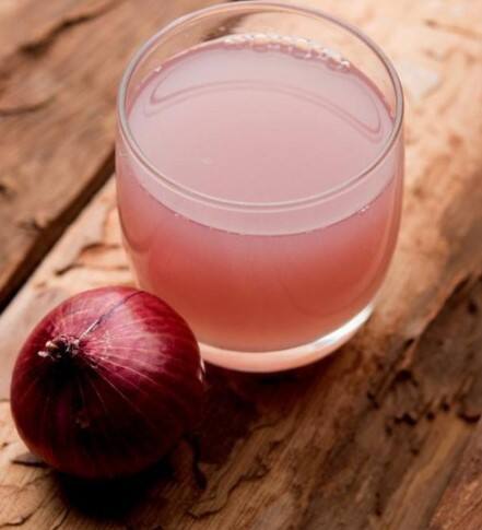 ਵਾਲਾਂ ਲਈ ਪਿਆਜ਼ ਦਾ ਰਸ: ਨਵੇਂ ਵਾਲ ਉਗਾਉਣ ਅਤੇ ਸਿਹਤਮੰਦ ਵਾਲਾਂ ਲਈ ਜਾਦੂਈ ਉਪਾਅ