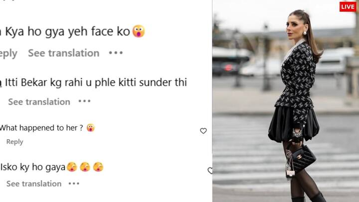 A user asked what happened to the face. At the same time, a user wrote- How beautiful was it before, now what happened. People are asking them what has happened to them.