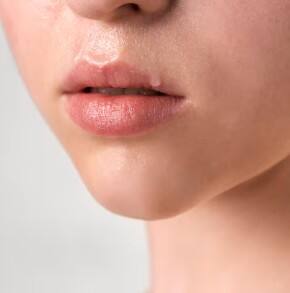 ਫੱਟੇ ਹੋਏ ਬੁੱਲ੍ਹਾਂ ਨੂੰ ਬਣਾਓ ਨਰਮ ਤੇ ਗੁਲਾਬੀ; ਵਰਤੋਂ ਇਹ ਆਸਾਨ ਘਰੇਲੂ ਨੁਸਖੇ