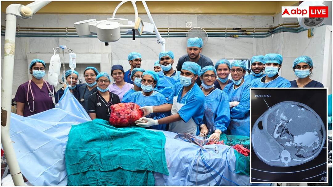 सफदरजंग के डॉक्टरों ने किया चमत्कार, 19 साल की लड़की के पेट से निकाला 10 किलो का ट्यूमर New Delhi Safdarjung Hospital removed 10 kg tumor from 19 year old girl stomach ann सफदरजंग के डॉक्टरों ने किया चमत्कार, 19 साल की लड़की के पेट से निकाला 10 किलो का ट्यूमर