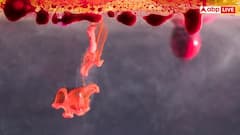 હાઈ કોલેસ્ટ્રોલના સંકેત: શરીરના આ 5 ભાગોમાં સતત દુખાવો વધે તો ચેતી જાવ! તાત્કાલિક ડોક્ટરને બતાવો