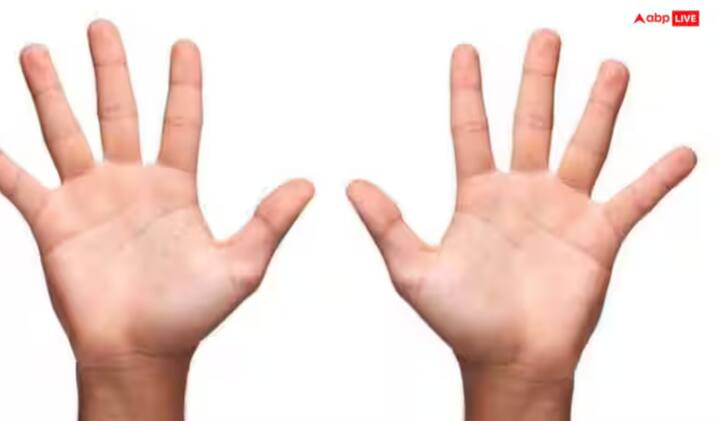 ਇਸ ਤਰ੍ਹਾਂ, ਤੁਹਾਡੇ ਹੱਥ ਦੀ ਹਥੇਲੀ 'ਤੇ ਕਿਸਮਤ ਦੀ ਰੇਖਾ ਇੱਕ ਵਿਅਕਤੀ ਦੇ ਜੀਵਨ ਦੀ ਇੱਕ ਖੁੱਲ੍ਹੀ ਕਿਤਾਬ ਵਾਂਗ ਹੈ। ਇਹ ਦੱਸਦੀ ਹੈ ਕਿ ਜੀਵਨ ਦੇ ਕਿਹੜੇ ਖੇਤਰ ਸਫਲਤਾ ਵੱਲ ਲੈ ਜਾਣਗੇ, ਕਿੱਥੇ ਰੁਕਾਵਟਾਂ ਆਉਣਗੀਆਂ, ਅਤੇ ਕਿਹੜੇ ਮੌਕੇ ਨਵੇਂ ਰਸਤੇ ਖੋਲ੍ਹਣਗੇ। ਇੱਕ ਟੁੱਟੀ ਹੋਈ ਰੇਖਾ ਅਸਥਾਈ ਮੁਸ਼ਕਲਾਂ ਨੂੰ ਦਰਸਾਉਂਦੀ ਹੈ, ਪਰ ਇਸਦਾ ਮਤਲਬ ਇਹ ਨਹੀਂ ਹੈ ਕਿ ਸਫਲਤਾ ਅਸੰਭਵ ਹੋਵੇਗੀ। ਸਗੋਂ, ਇਹ ਦਰਸਾਉਂਦੀ ਹੈ ਕਿ ਸਖ਼ਤ ਮਿਹਨਤ ਅਤੇ ਦ੍ਰਿੜ ਇਰਾਦੇ ਨਾਲ, ਇੱਕ ਵਿਅਕਤੀ ਆਪਣੀ ਕਿਸਮਤ ਖੁਦ ਬਣਾ ਸਕਦਾ ਹੈ।