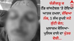 ਚੰਡੀਗੜ੍ਹ 'ਚ ਹੈੱਡ ਕਾਂਸਟੇਬਲ 'ਤੇ ਹੋਇਆ ਘਾਤਕ ਹਮਲਾ, ਵੱਢਿਆ ਨੱਕ, 1 ਲੱਖ ਰੁਪਏ ਸਣੇ ਲੁੱਟੀ ਚੇਨ; ਮੁਲਾਜ਼ਮ ਬੋਲਿਆ- ਪੁਲਿਸ ਵਾਲੇ ਦਾ ਪੁੱਤਰ ਦੋਸ਼ੀ...