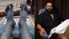 ऋषभ शेट्टी ने छुपाकर रखा था दर्द, 'कांतारा चैप्टर 1' हिट होते ही दिखाई डरावनी तस्वीरें