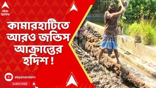 Kamarhati News : কামারহাটি পুরসভার ১০ নং ওয়ার্ডে ফের জন্ডিস আক্রান্তের হদিশ !