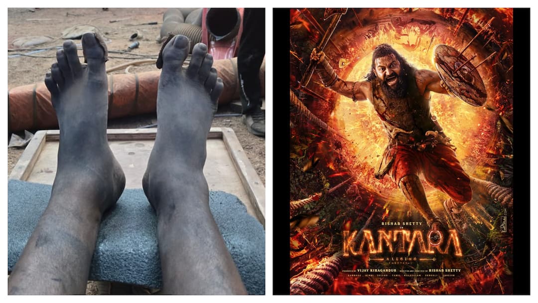 Swollen Feet, Exhausted Body: Rishab Shetty Shares BTS Of Kantara Chapter 1 Climax Swollen Feet, Exhausted Body: Rishab Shetty Shares BTS Of Kantara Chapter 1 Climax