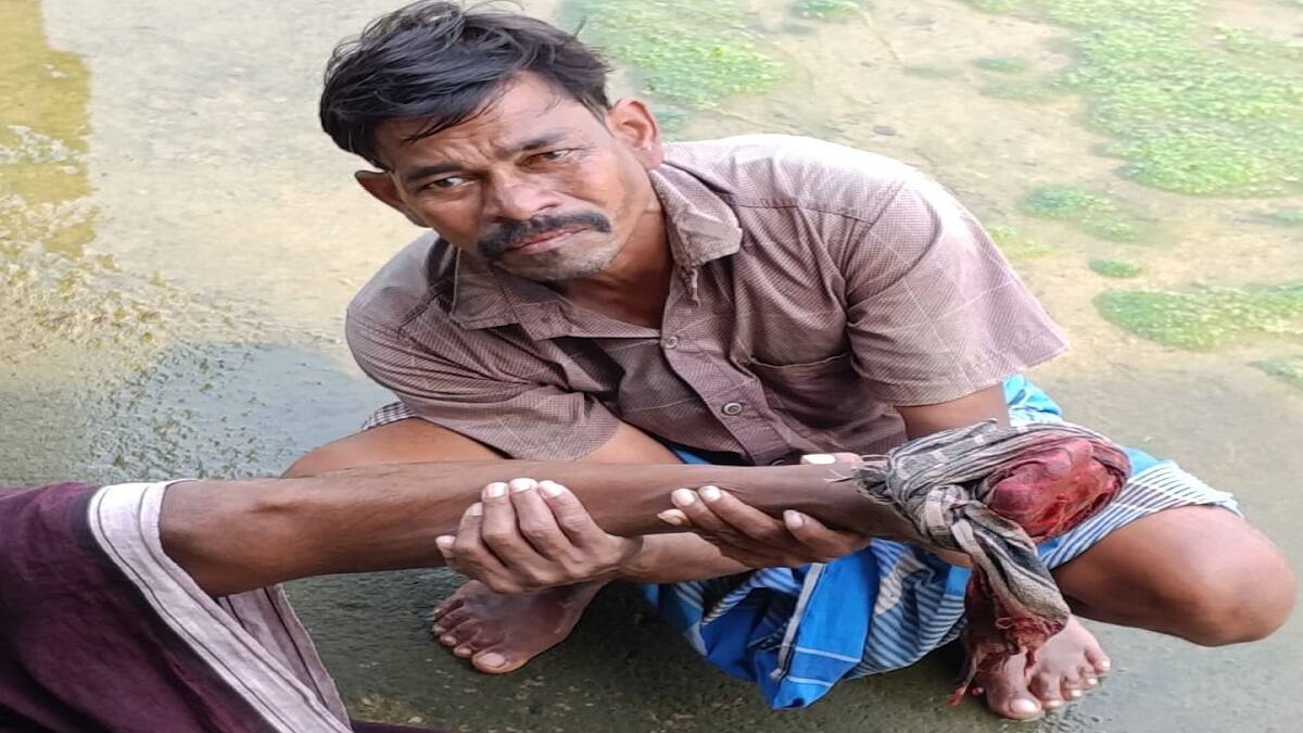 கும்பகோணம் அருகே அணைக்கரையில் மீன் பிடித்தபோது பயங்கரம்: மீனவர் காலை கடித்த முதலை