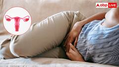 हर महिला को जानना जरूरी, क्या है PCOD और PCOS में अंतर, कैसे करें इनकी सही पहचान?