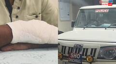 यमुनानगर में तस्कर को पकड़ने गई पुलिस पर जानलेवा हमला, थाना प्रभारी लहूलुहान