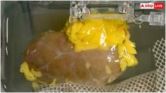 अब नहीं रुकेगा किसी भी ब्लड ग्रुप के मरीज का किडनी ट्रांसप्लांट, वैज्ञानिकों ने बना ली यूनिवर्सल किडनी