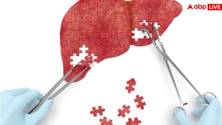 दूसरा लक्षण है पैरों और गुल्फ में सूजन. अगर रात में लेटते वक्त पैरों में सूजन आ जाती है और सुबह उठने पर भी यह बनी रहती है, तो इसे इग्नोर करना गलत है. यह लिवर की क्षमता कमजोर होने और बॉडी में फ्लुइड रिटेंशन का संकेत है.