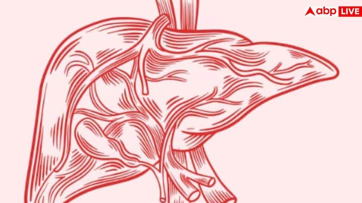 पांचवां लक्षण है पेट में फ्लुइड जमा होना यानी एस्काइटिस. जब लिवर बुरी तरह प्रभावित होता है तो पेट के अंदर तरल भरने लगता है. इससे बिस्तर पर लेटते समय सांस लेने में तकलीफ और असामान्य भारीपन महसूस होता है. यह लिवर डिजीज का एडवांस स्टेज का लक्षण है.