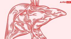 Symptoms of blocked arteries: पैरों में दिखने लगें ये लक्षण तो समझ लें ब्लॉक हो रहीं आर्टरीज, तुरंत भागें डॉक्टर के पास