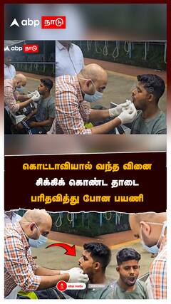 கொட்டாவியால் வந்த வினை! சிக்கிக் கொண்ட தாடை! பரிதவித்து போன பயணி:Passenger jaw dislocation