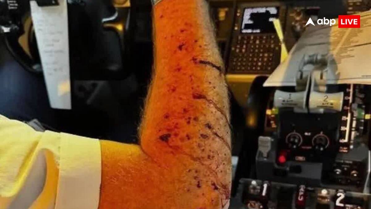 United Airlines UA1093: 36వేల అడుగుల ఎత్తులో ఉండగా పగిలిన విమానం విండ్‌షీల్డ్‌, టెన్షన్ పడ్డ 140 మంది ప్రయాణికులు