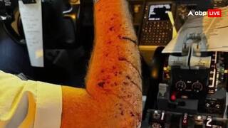 United Airlines UA1093: 36వేల అడుగుల ఎత్తులో ఉండగా పగిలిన విమానం విండ్షీల్డ్, టెన్షన్ పడ్డ 140 మంది ప్రయాణికులు